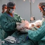 Transplante